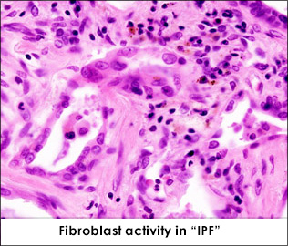 fibroblast_activity_1