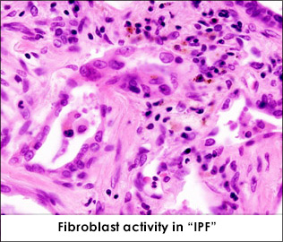 fibroblast_activity_1